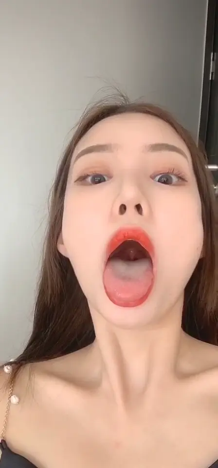#口腔 口腔 14