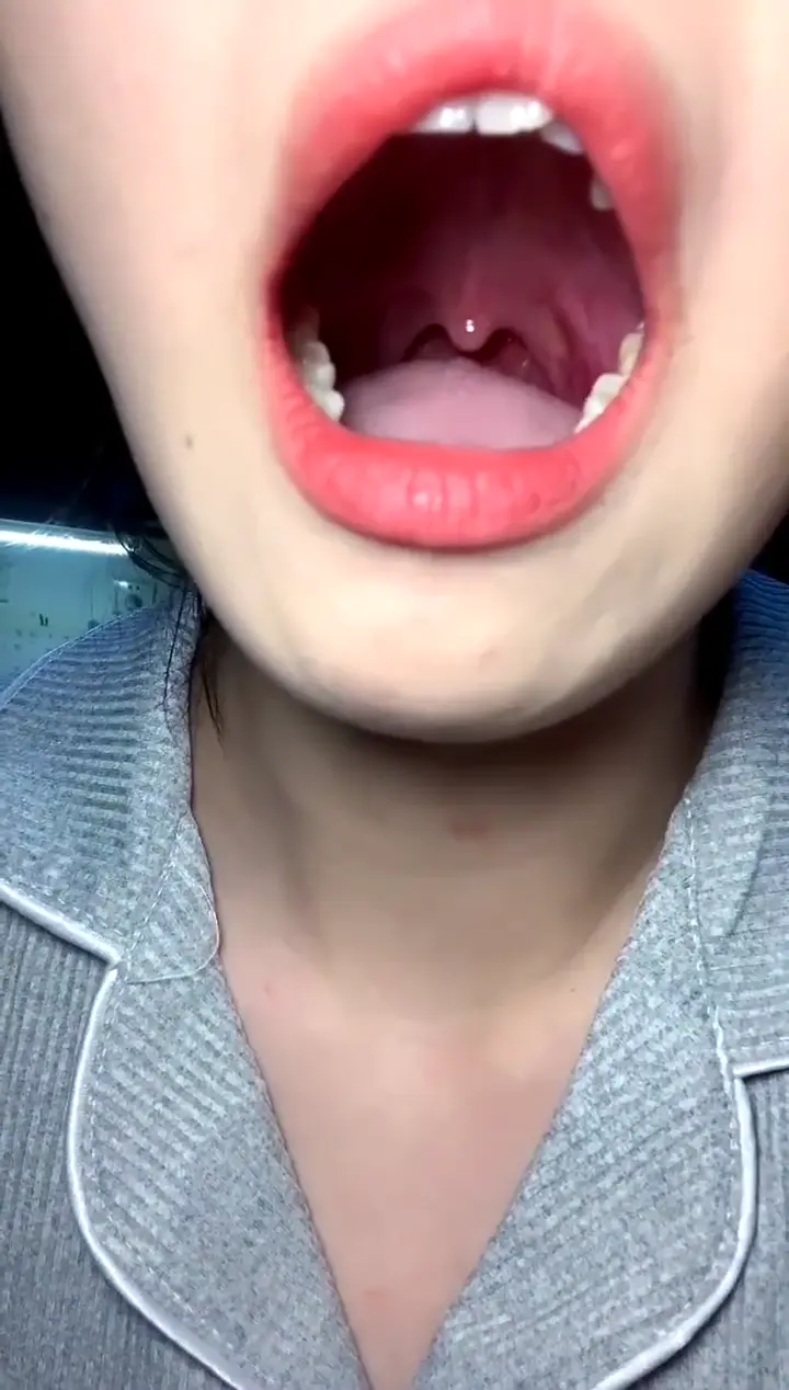 #口腔 口腔 12