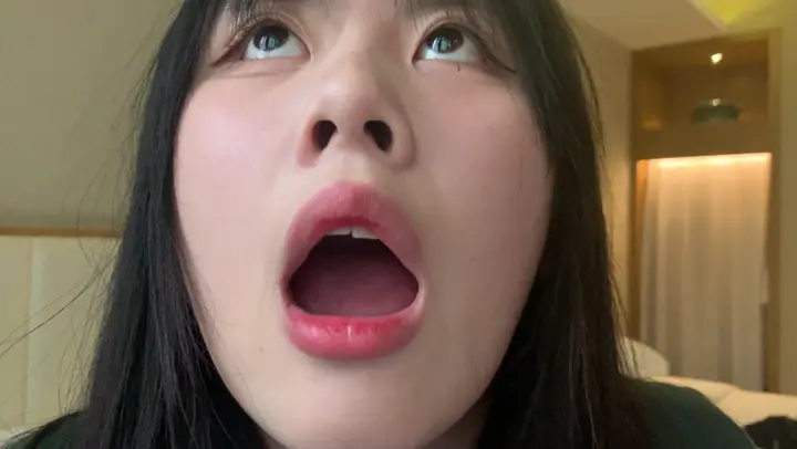 #口腔 口腔 13