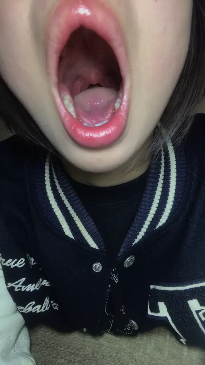 #口腔 口腔 1