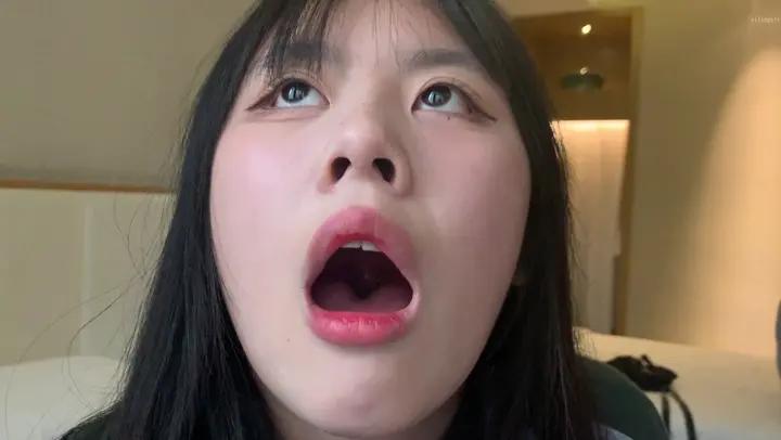 #口腔 口腔 13