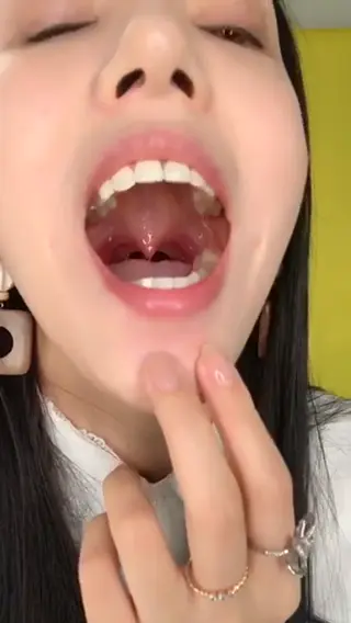 #口腔 口腔 6