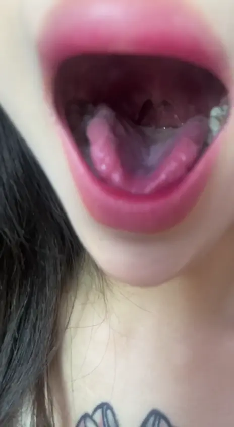 #口腔 口腔 3