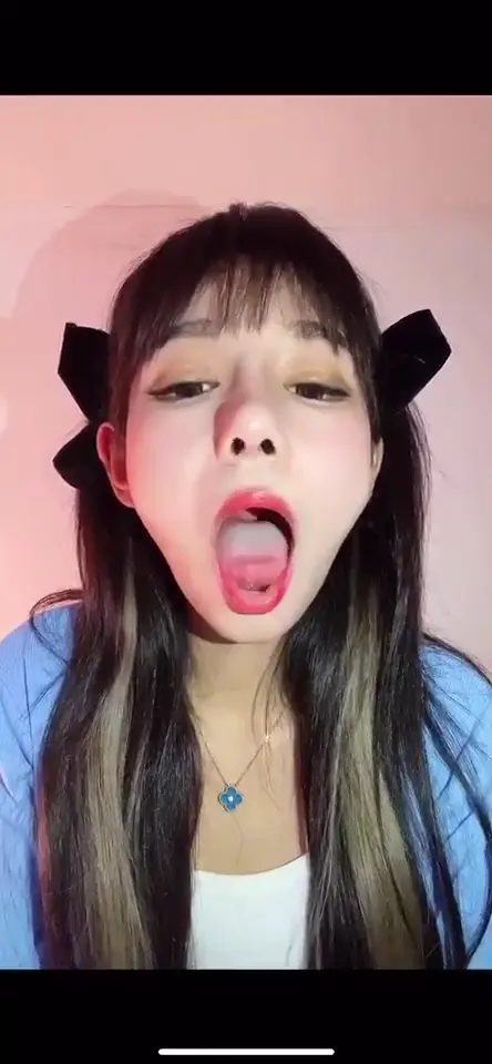 #口腔 口腔 14