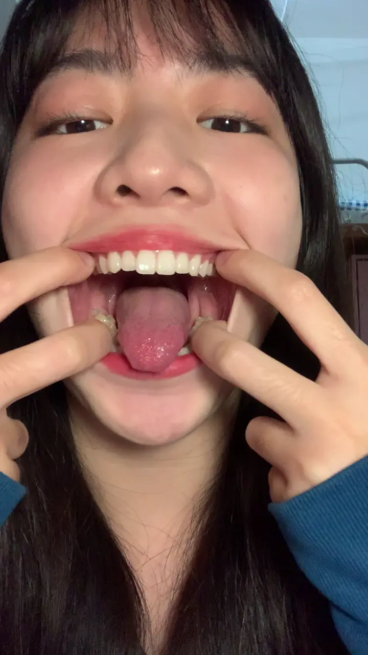 #口腔 口腔 10
