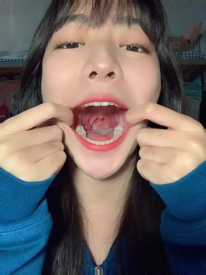 #口腔 口腔 10