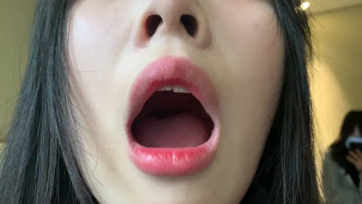 #口腔 口腔 13