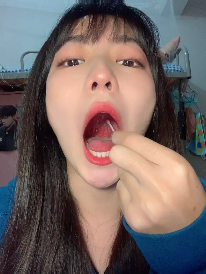 #口腔 口腔 11