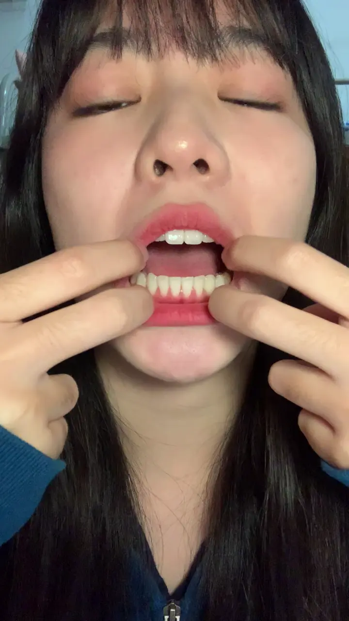#口腔 口腔 11