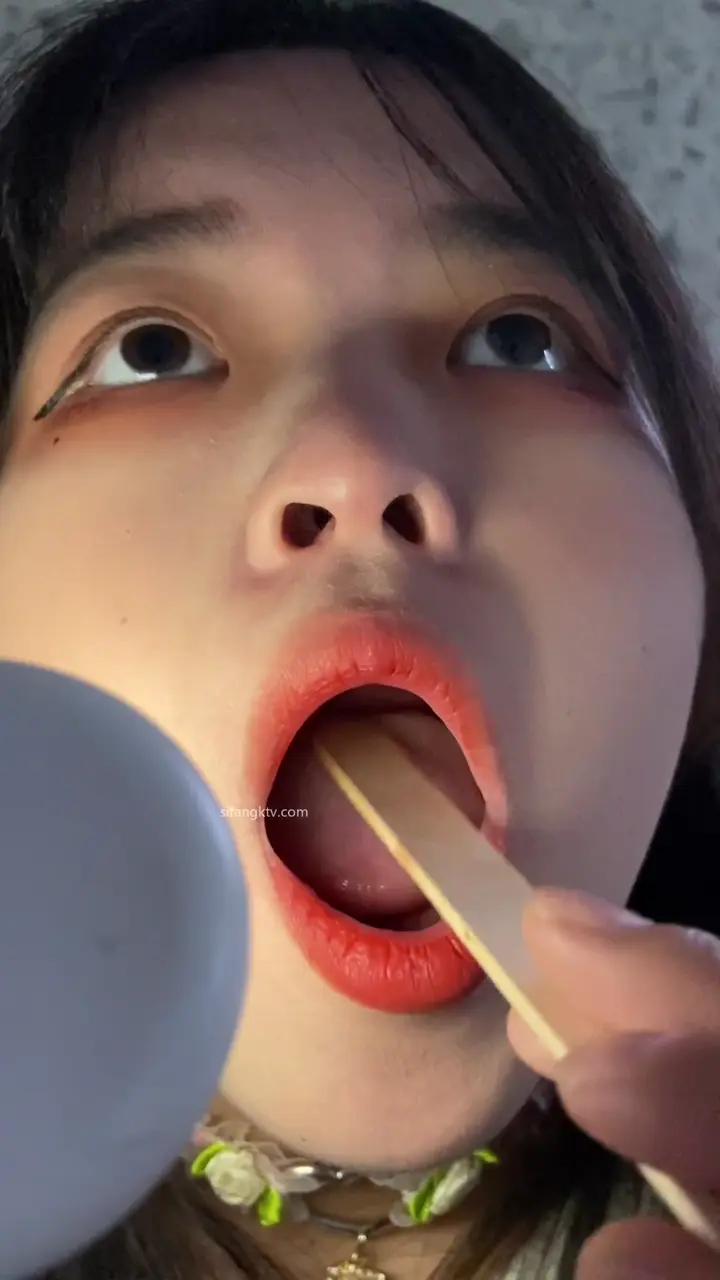 #口腔 口腔 4