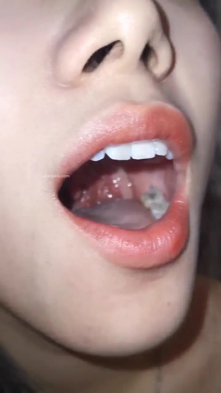#口腔 口腔 5