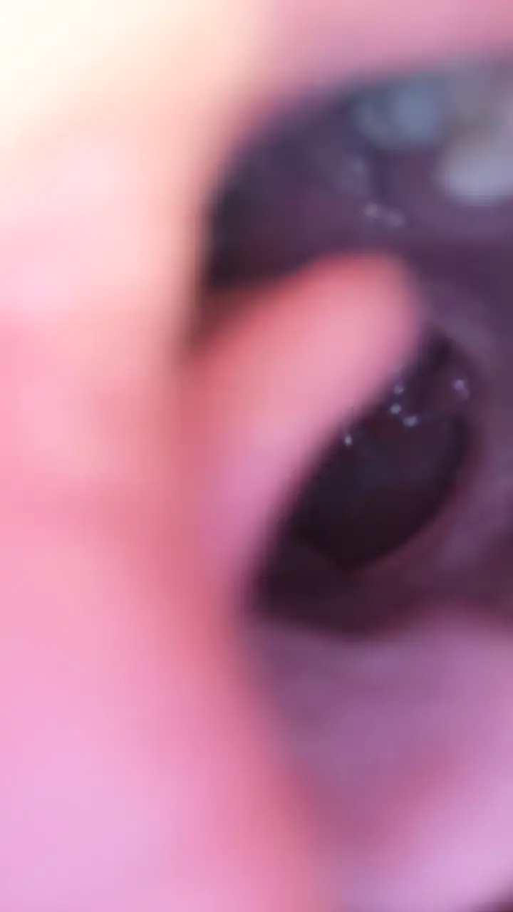 #口腔 口腔 1