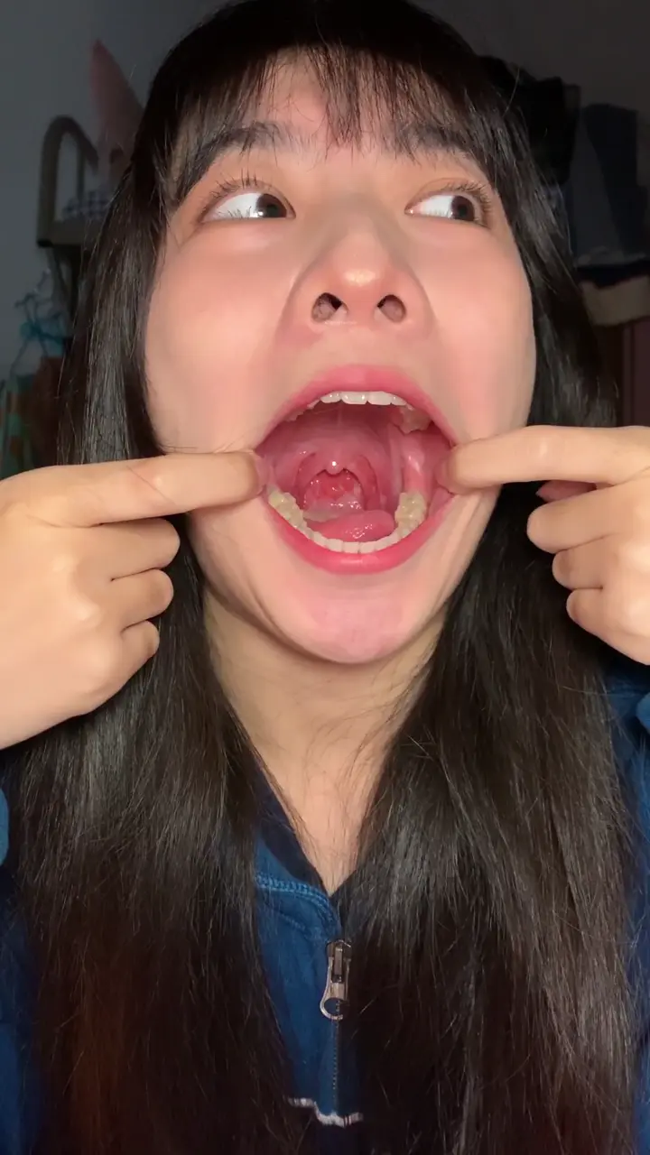 #口腔 口腔 2