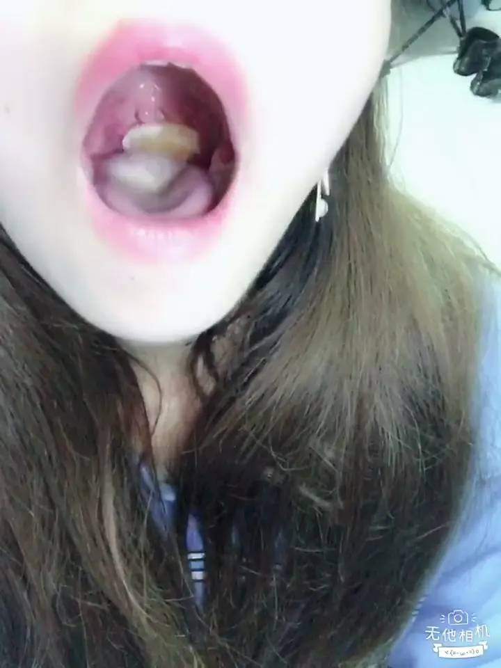 #口腔 口腔 1