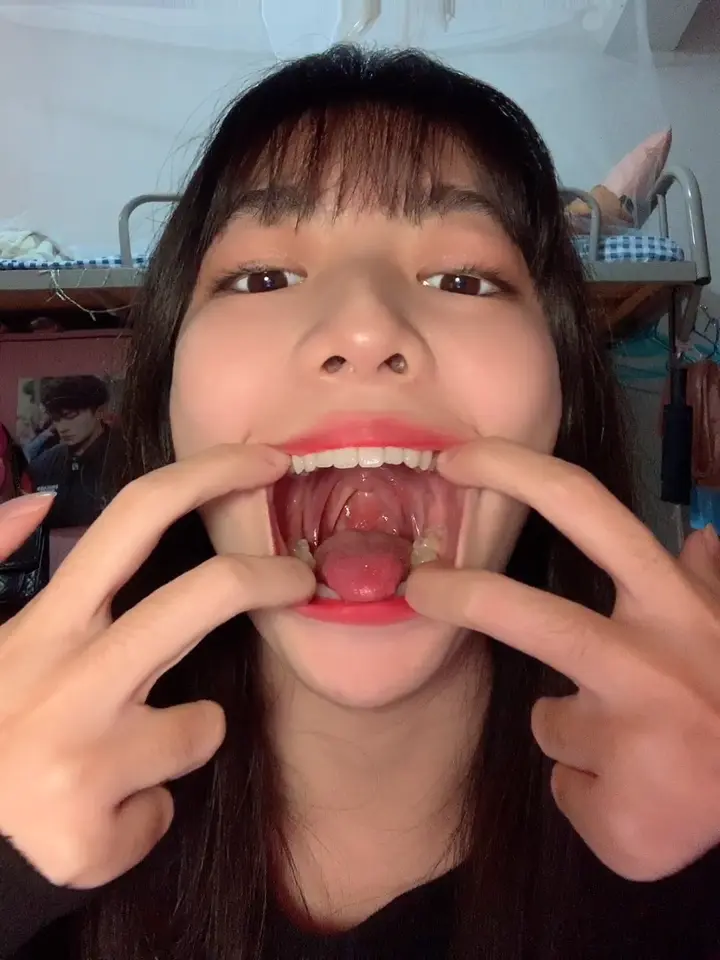 #口腔 口腔 11