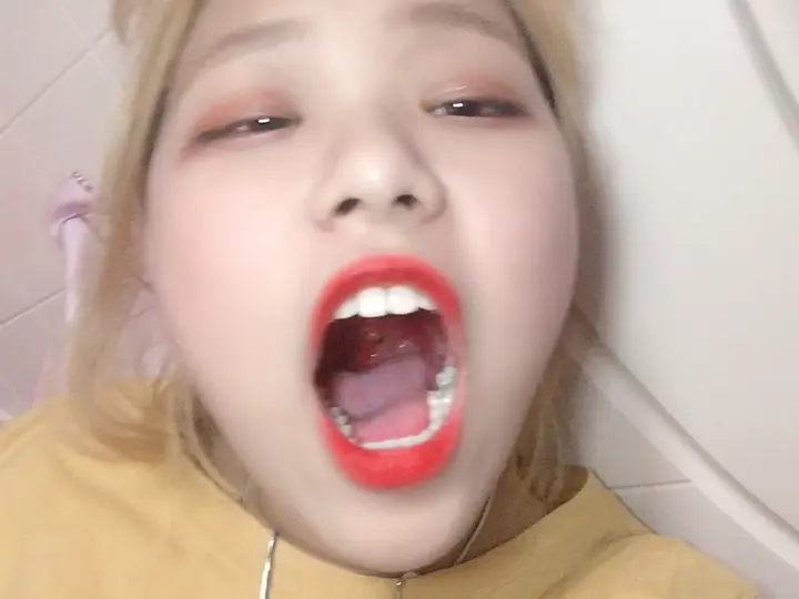 #口腔 口腔 15
