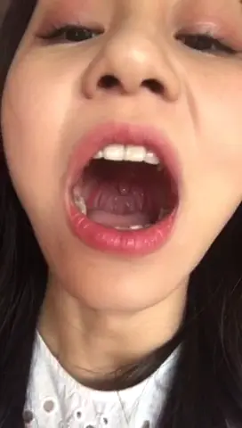 #口腔 口腔 6