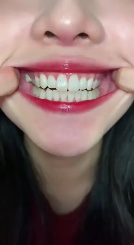 #口腔 口腔 2