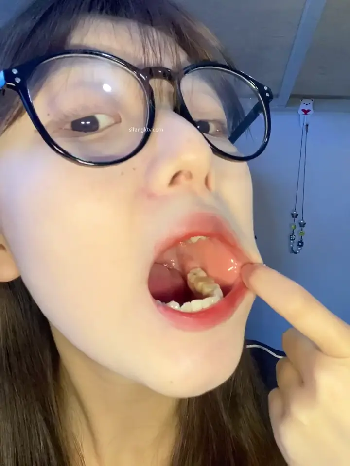 #口腔 口腔 7