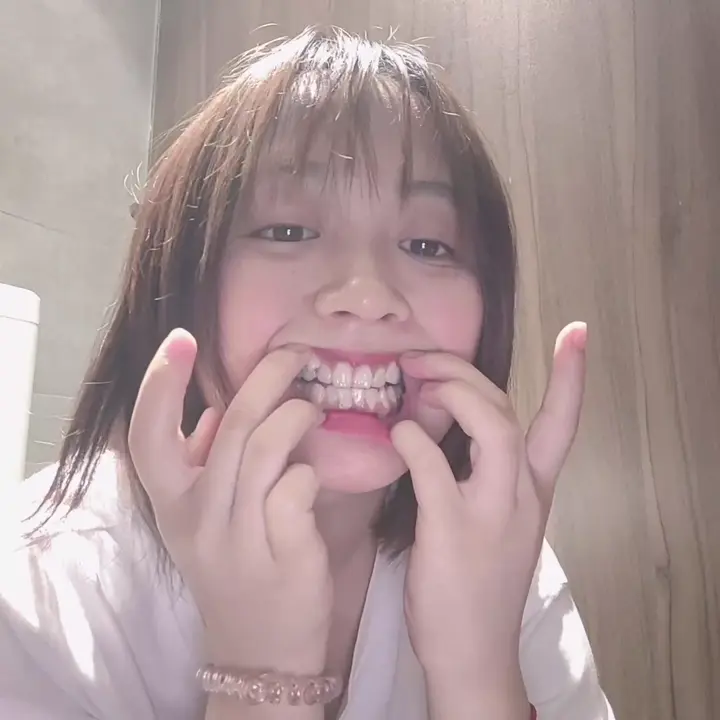 #口腔 口腔 15