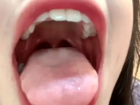 #口腔 口腔 6