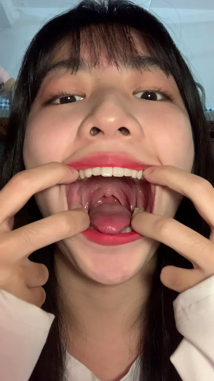 #口腔 口腔 11
